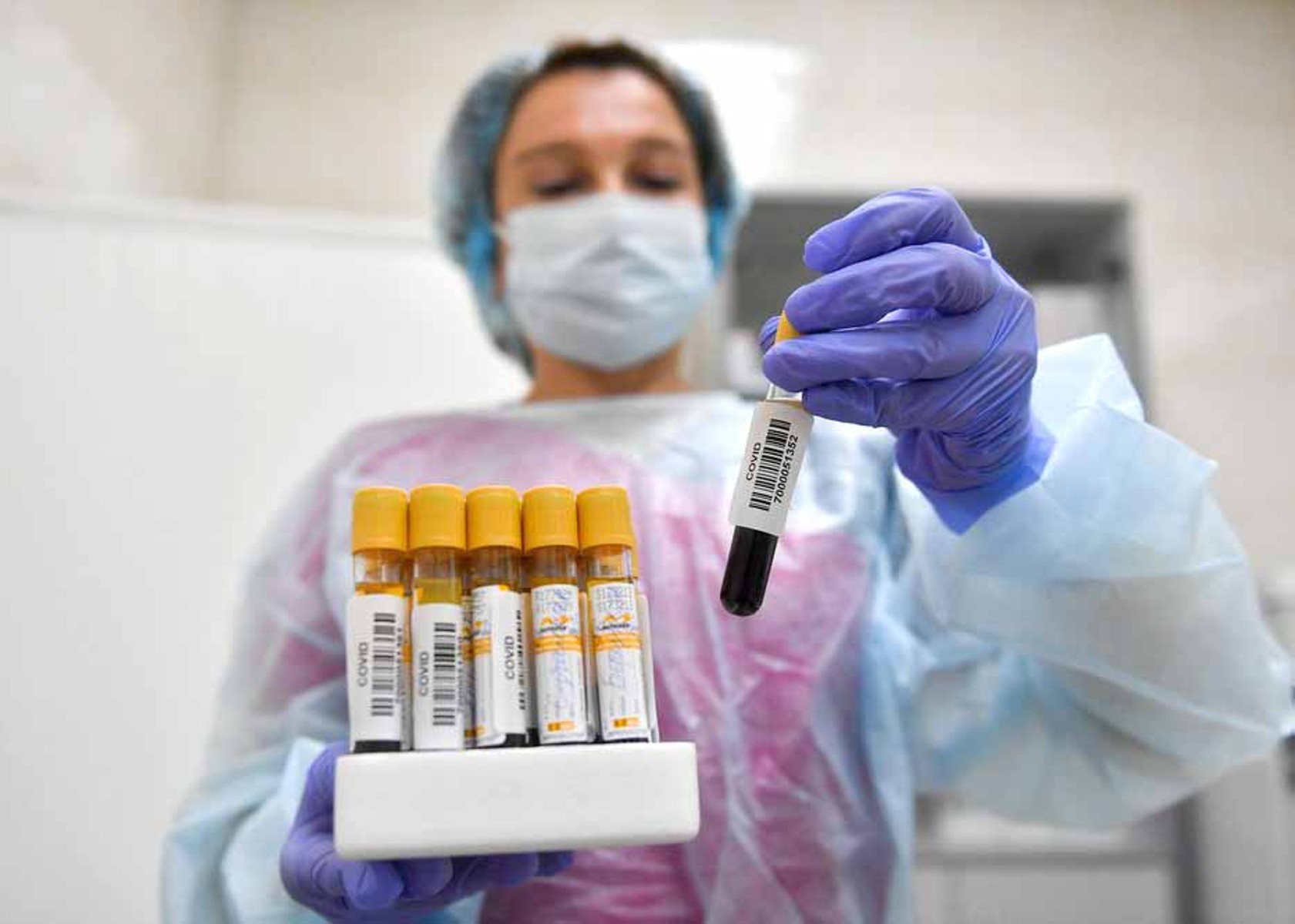 В регионе за последние сутки зафиксировано 90 случаев COVID-19